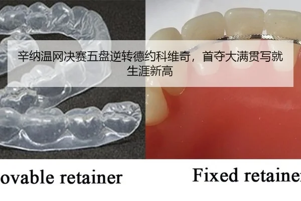 xin-na-wen-wang-jue-sai-wu-pan-ni-zhuan-de-yue-ke-wei-qi-shou-duo-da-man-guan-xie-jiu-sheng-ya-xin-gao-2-356.jpg